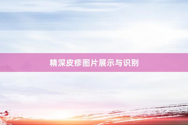 精深皮疹图片展示与识别
